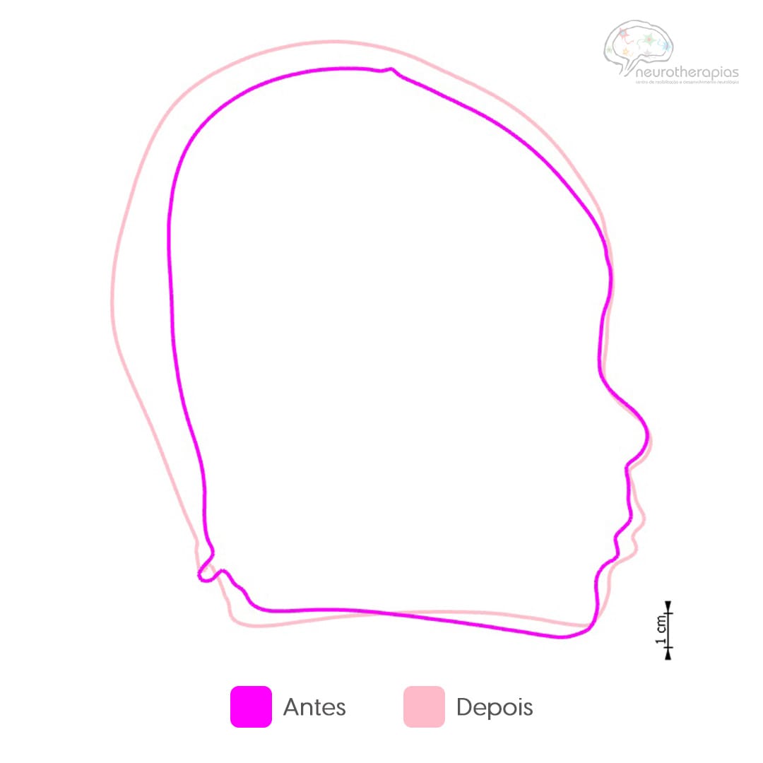 Neurotherapias - Carrossel - 1
