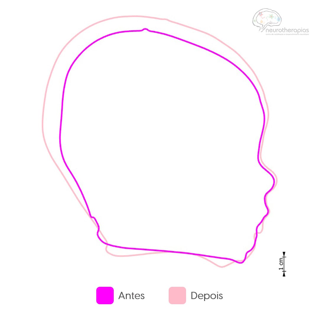 Neurotherapias - Carrossel - 3