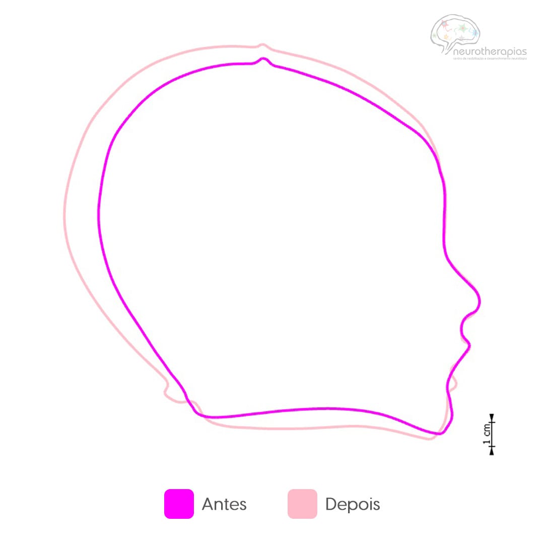 Neurotherapias - Carrossel - 6